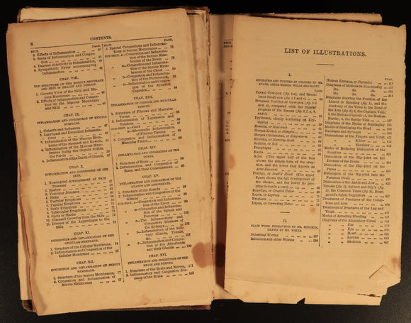 1858 Manual Of Domestic Medicine & Surgery by JH Walsh Antiquarian Medical Book