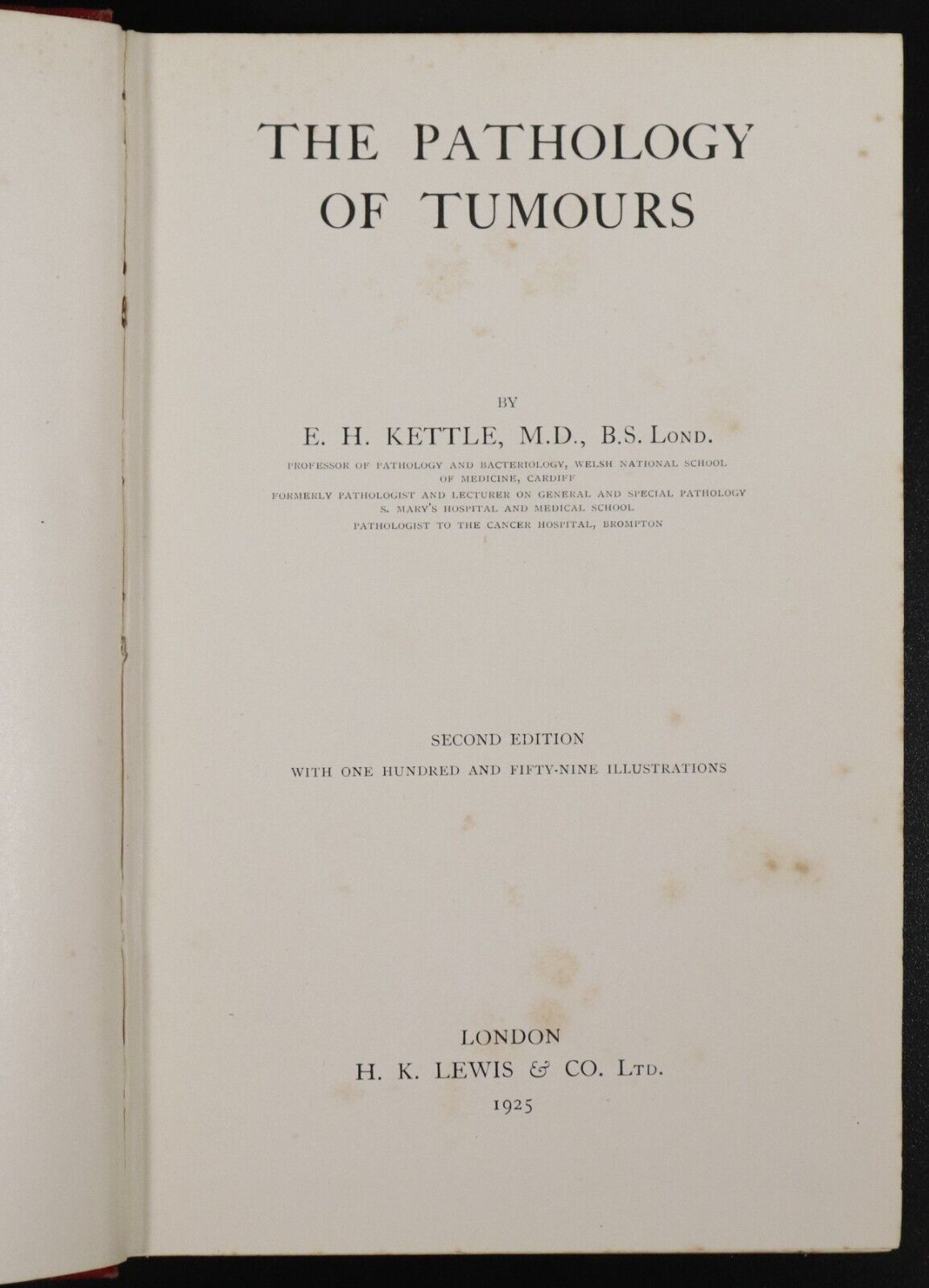 1925 The Pathology Of Tumours by E.H. Kettle Antique Medical Research Book - 0
