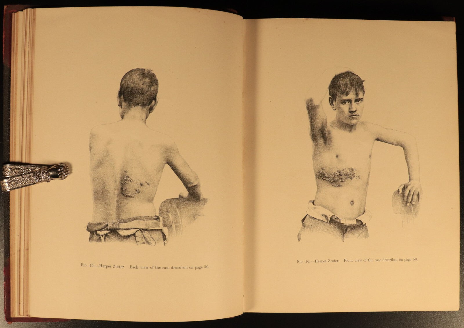 1890 Studies In Clinical Medicine by Byrom Bramwell Antiquarian Medical Book