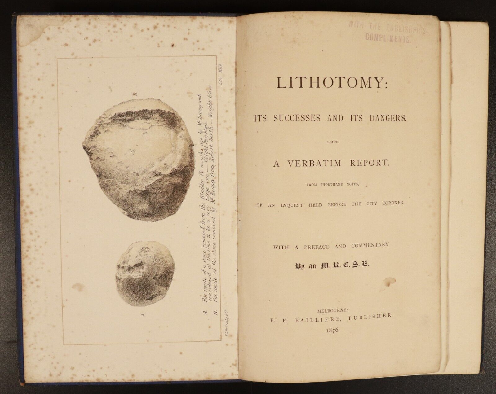 1876 Lithotomy: Its Successes & Dangers Antique Australian Medical History Book - 0