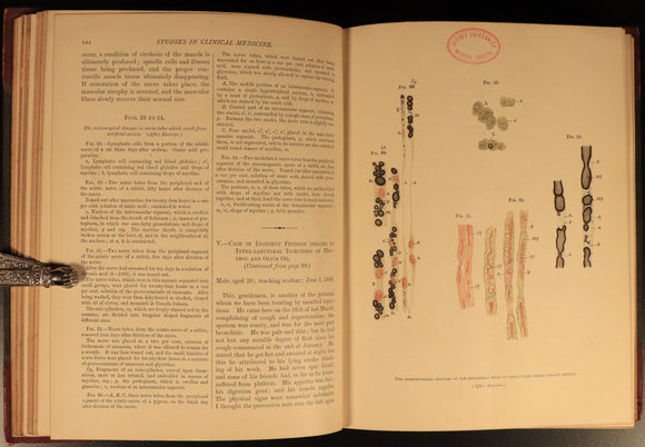 1890 Studies In Clinical Medicine by Byrom Bramwell Antiquarian Medical Book