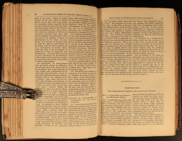 1858 Manual Of Domestic Medicine & Surgery by JH Walsh Antiquarian Medical Book