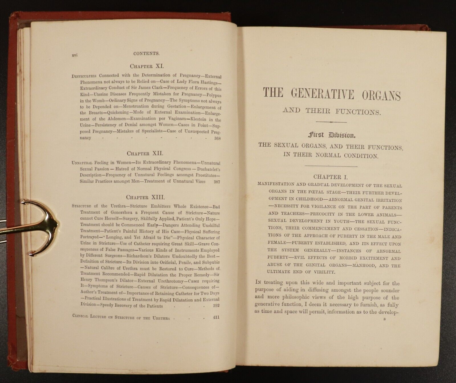 1883 The Generative System In Health & Disease by JG Beaney Antique Medical Book